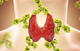 I štitna žlijezda ima svoju omiljenu hranu — a od nekih namirnica joj nije dobro I štitna žlijezda ima svoju omiljenu hranu — a od nekih namirnica joj nije dobro